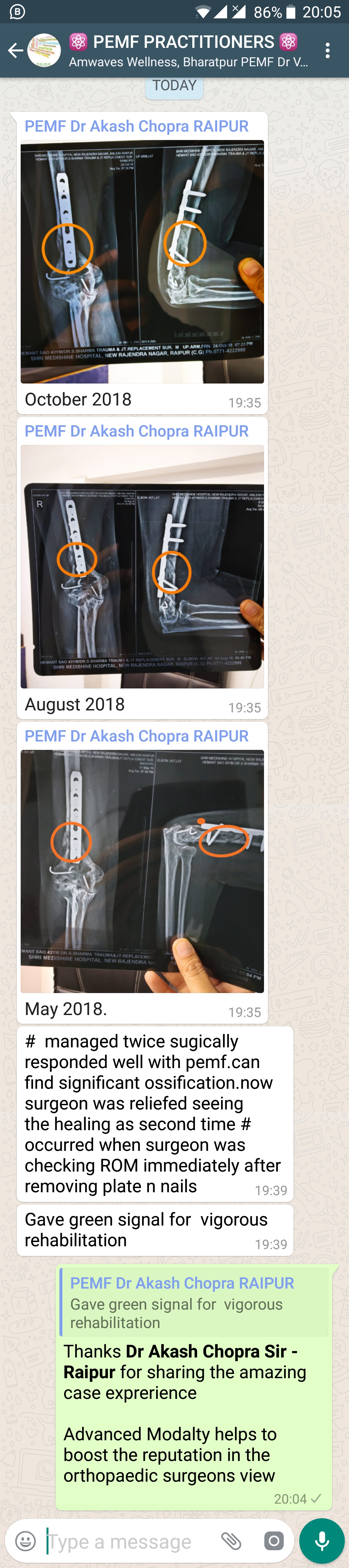 https://www.amwaveswellness.com/assets/uploads/testimonial_image/1255-fracture-healing-x-ray-=-dr-akash-chopra-=-raipur.jpg